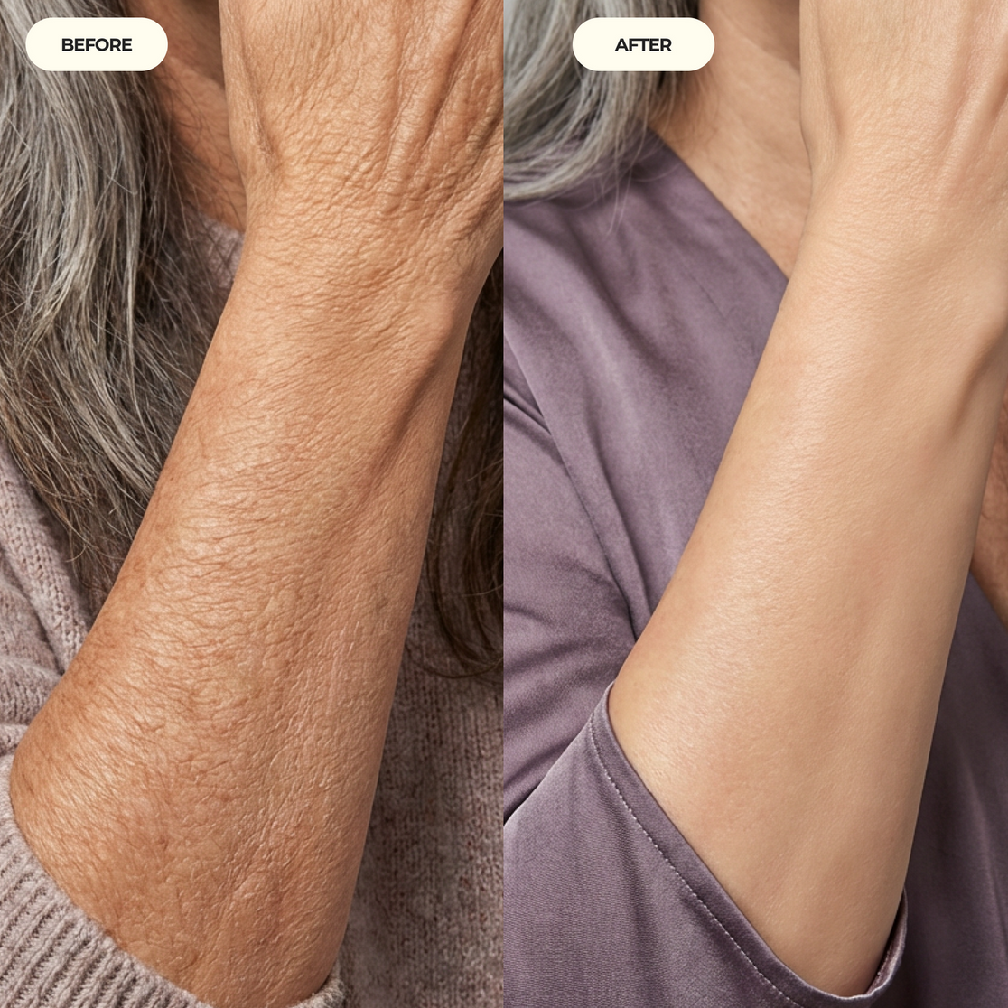 Before and after comparison of the skin on a forearm