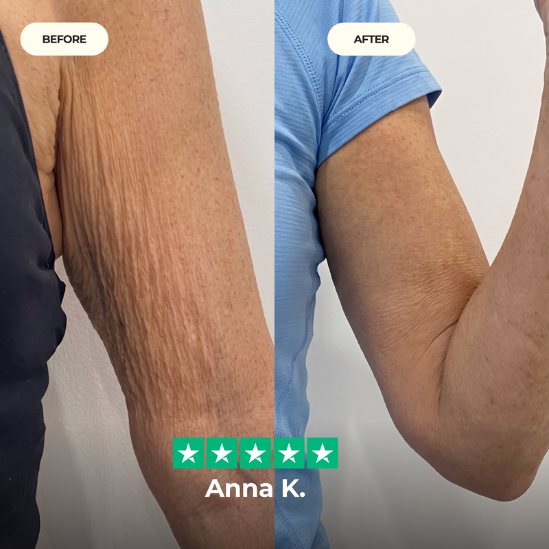 Applying serum to the legs at home